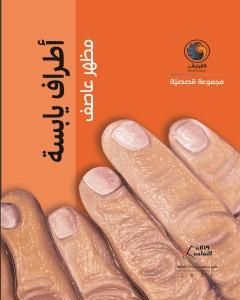 أطراف يابسة