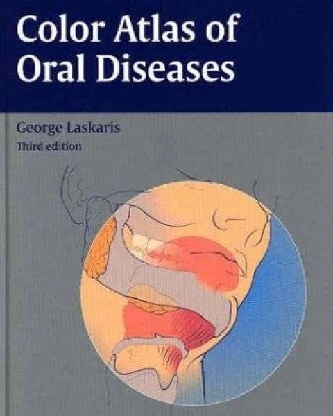 Color Atlas of Oral Diseases